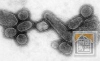 200px-Reconstructed_Spanish_Flu_Virus.jpg